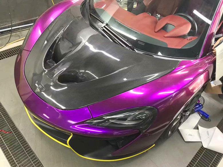 McLaren 570s/570GT/540C/600LT Carbon Fiber Vented Hood